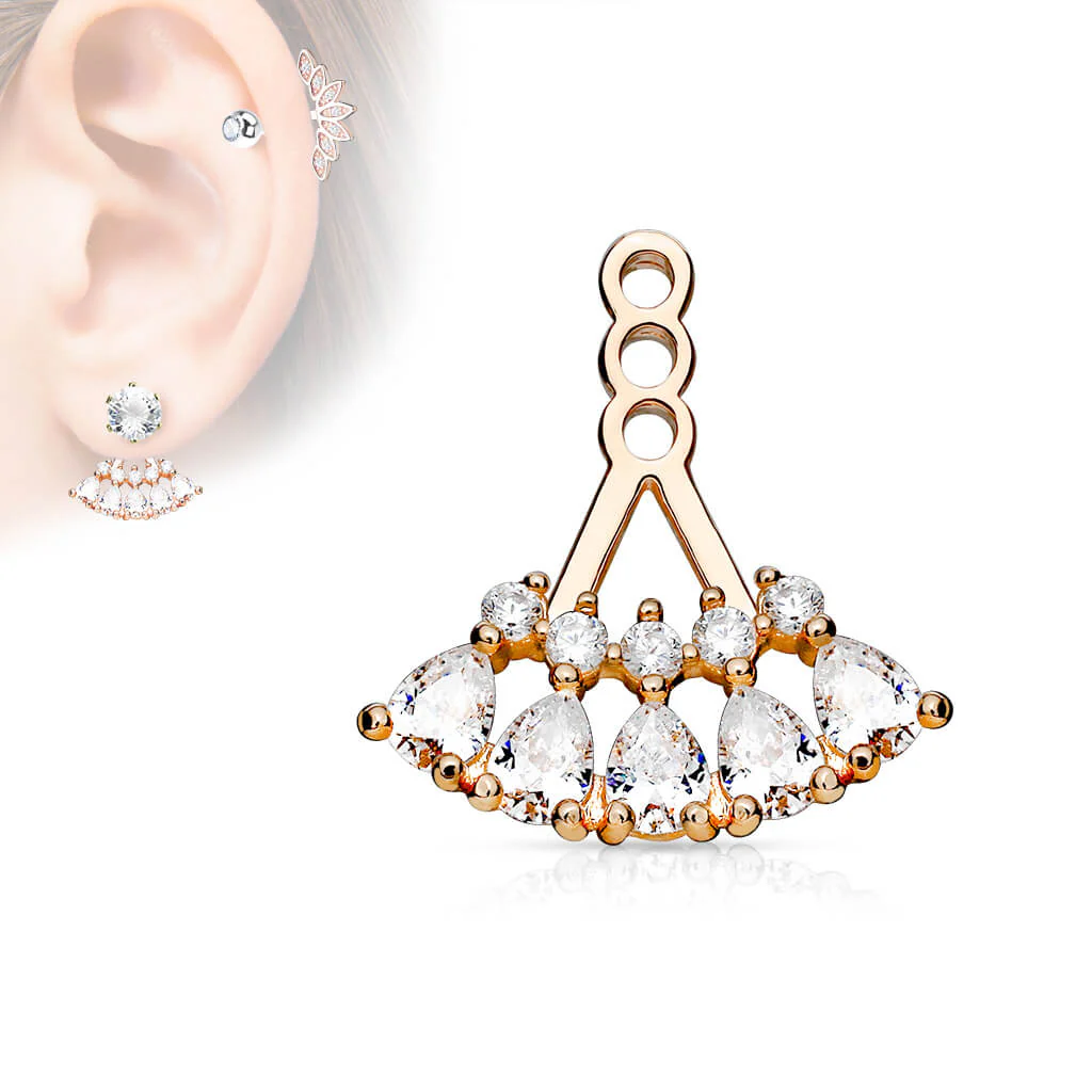 Attachment TearDrop Zirconia - Image 3